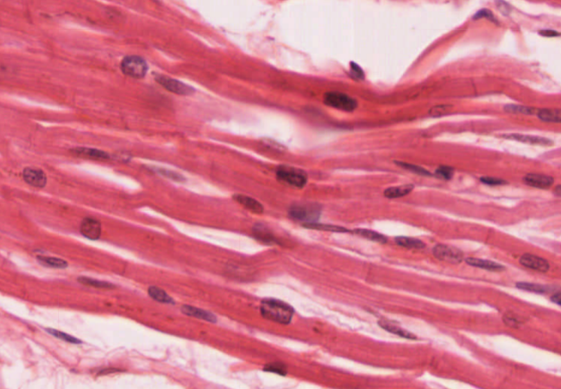 <p>what type of muscle tissue is this? </p>