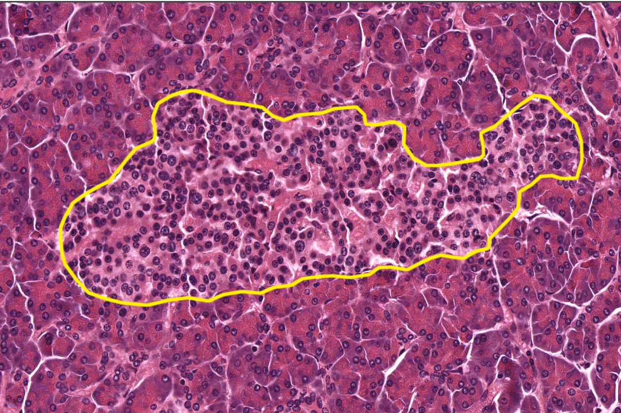 <p>Pancreas</p><p><strong>NOTICE: ISLET OF LANGERHANS WHICH ARE ENDOCRINE CELLS ALL PACKED TOGETHER</strong></p>