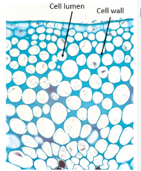 <p>living cells at maturity, unevenly thickened primary cell wall with no lignified secondary cell wall, more differentiated than parenchyma, function in flexible support, primarily in cortex of young plants</p>