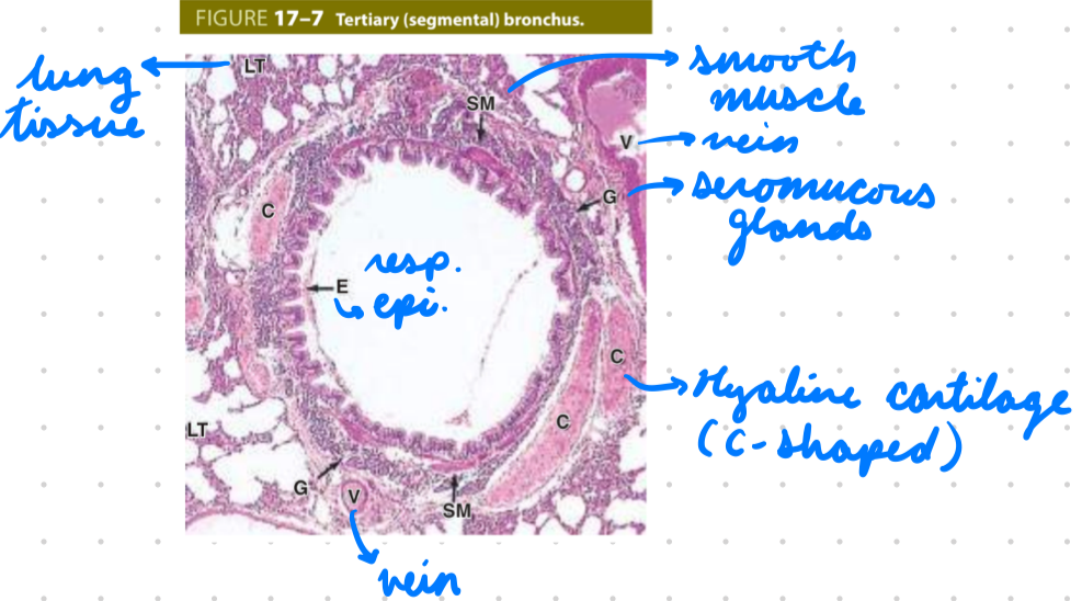 <p>Primary Bronchi: Resp epithelium + cartilage rings</p><ul><li><p>Mucous and serous glands</p></li><li><p>Smooth muscles</p></li><li><p>Elastic fibres</p></li></ul><p>Other Bronchi: Resp epithelium + hyaline cartilage</p><ul><li><p>Increase smooth muscles and elastic fibres</p></li></ul><p></p>