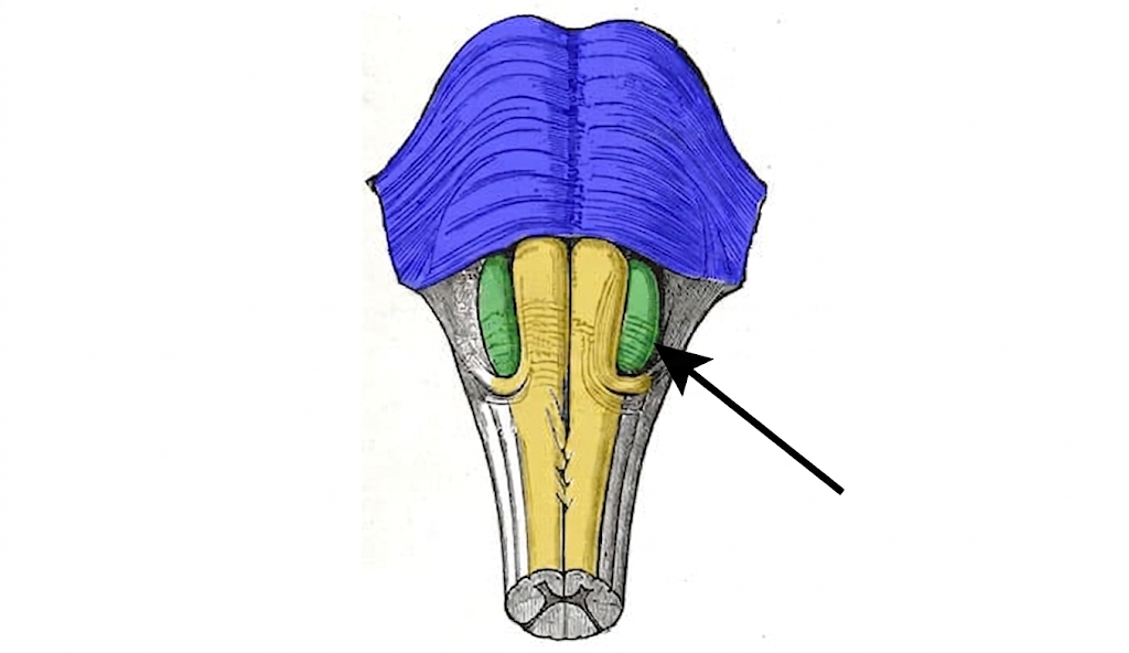 term image
