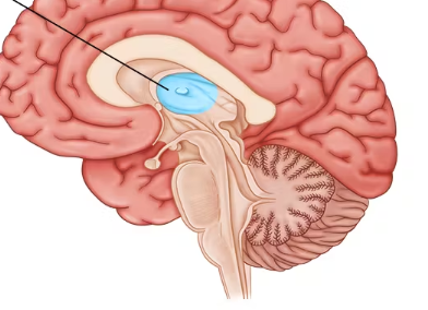 <p><span>The largest part of the Diencephalon. It consists of two lateral portions connected by a stalk called the interthalamic adhesion, which is sometimes referred to as the intermediate mass. Carries all sensory information to the cerebral cortex, with the exception of the sense of smell, which is carried directly to the frontal lobe of the cerebral cortex by the olfactory nerves. </span></p><p></p><p><span>Sometimes referred to as a relay station for sensory information. Also intimately involved in emotions due to its connections to the limbic system.</span></p>