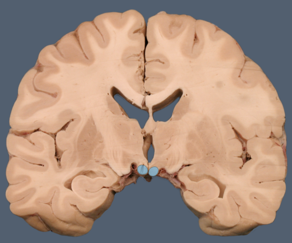 term image