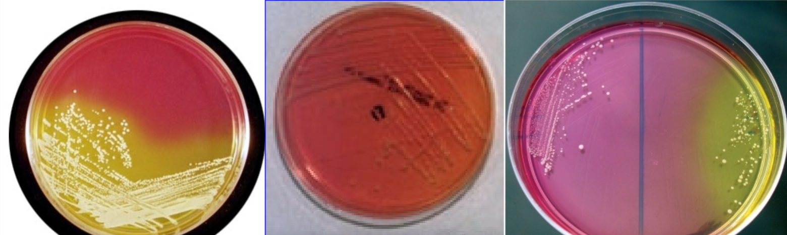 <p>Mannitol Salt Agar (MSA) positive result</p>