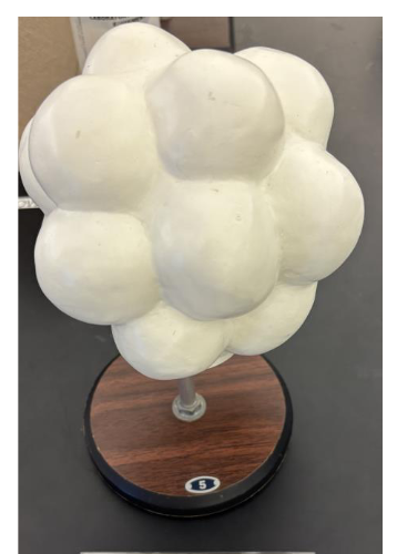 <p>what stage is this </p>