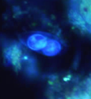 <p>genus, species, stage</p>