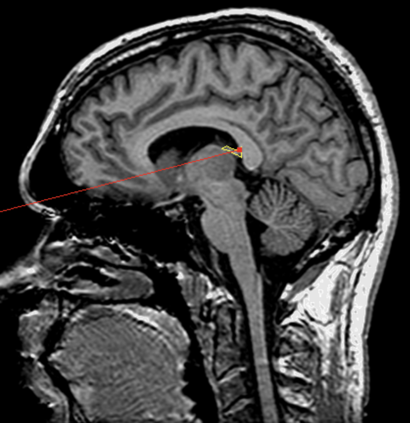 <p>What is the area highlighted called?</p>