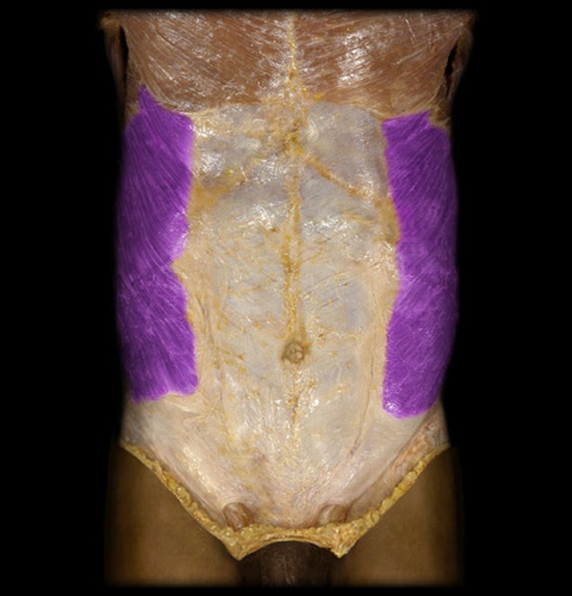 <p>origin: lower 8 ribs</p><p>insertion: ilium and linea alba</p><p>action: flexion and rotation at waist</p>