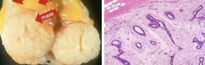 <p>What pathology?</p>