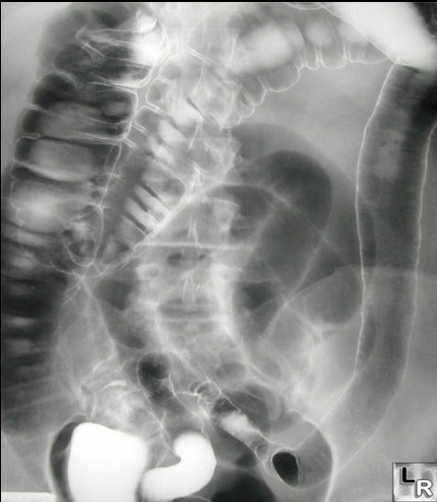 <p>pathology?</p>