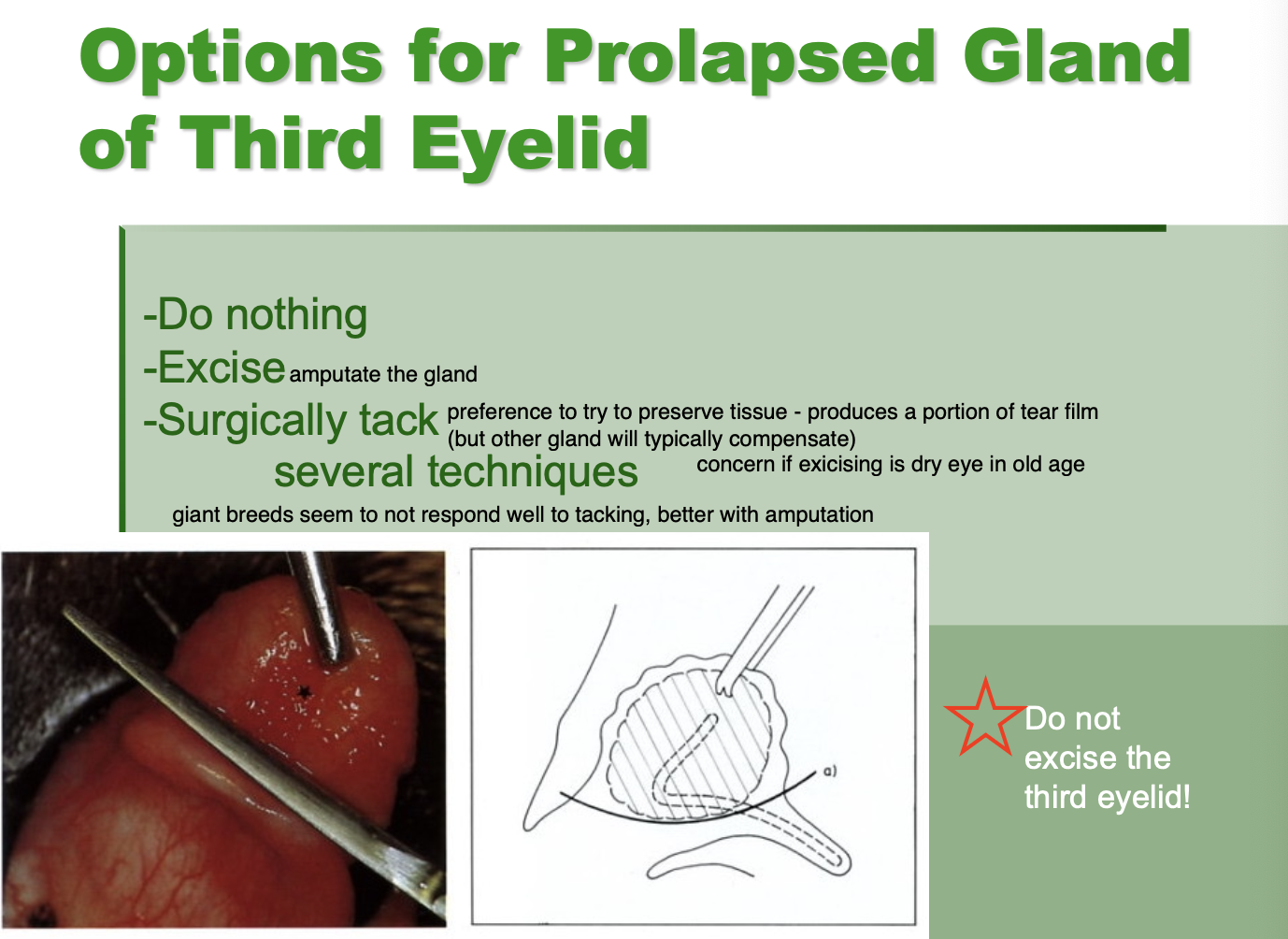 <p>removal increases risk of dry eye.</p>