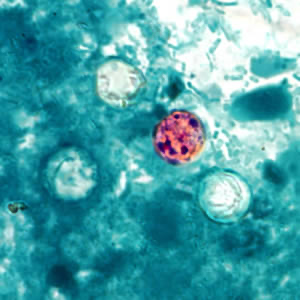 <p>Modified Acid Fast Stain</p><p>Associated with rasberries and basil</p>