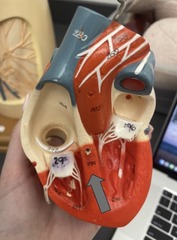 <p>separates ventricles</p><p>295</p>