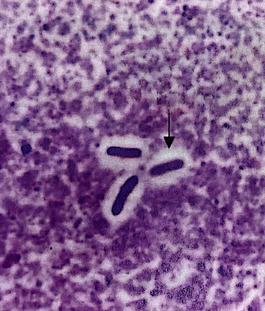 <p>Distinct, firm, and sticky polysaccharide layer </p><p>easiest to find towards the edge of the sample where the stain is the thickest </p>