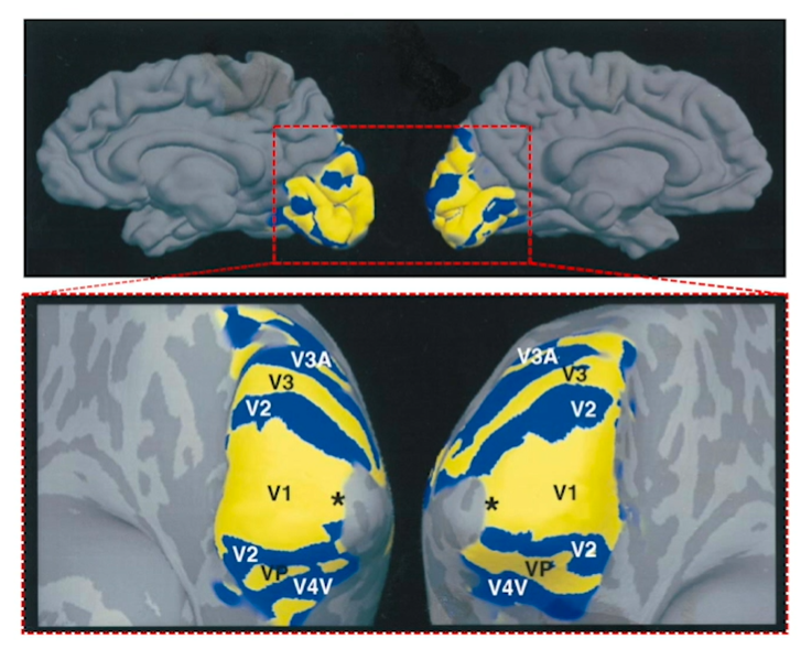 <p>Bidirectional connections (travels ventrally &amp; dorsally)</p>