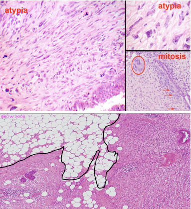 <p>What pathology?</p>