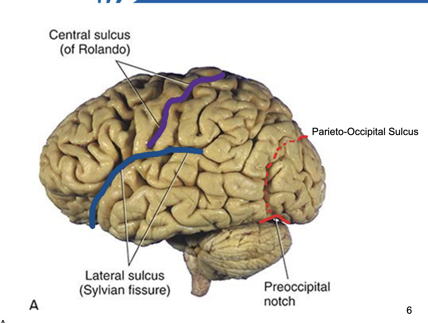 <ul><li><p>Longitudinal fissure</p></li></ul><ul><li><p>Central sulcus (Rolando sulcus)</p></li><li><p>Lateral sulcus (Sylvian fissure)</p></li><li><p>Parieto-occipital sulcus</p></li><li><p>Preocciptital notch<span style="color: transparent;">us</span></p></li></ul><p><strong>Memory trick: LCLP</strong></p><p>(Longitudinal → Central → Lateral → Parieto-occipital)</p>