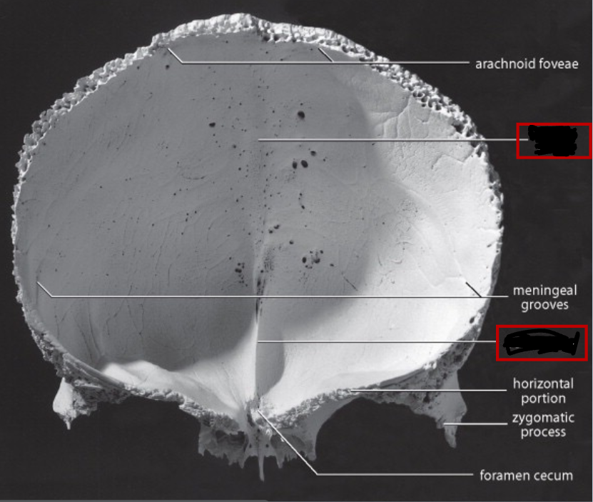 <p>frontal bone (braincase), fill in the blanks</p><p>an endocranial view (posterior)</p>