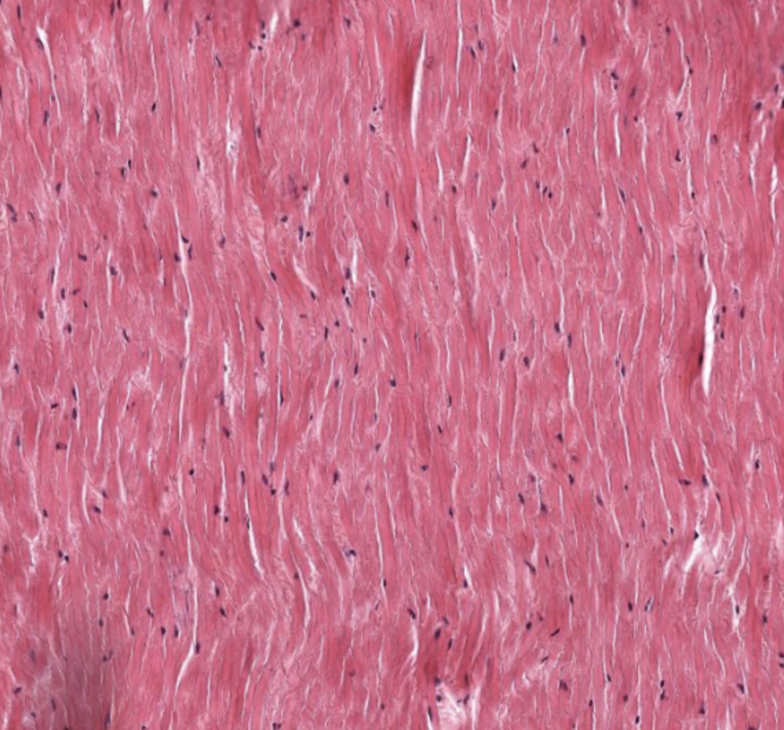 <p>tissue type</p>