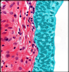<p>Identify the highlighted structure</p>