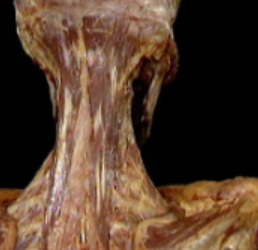 <p>what muscle</p>