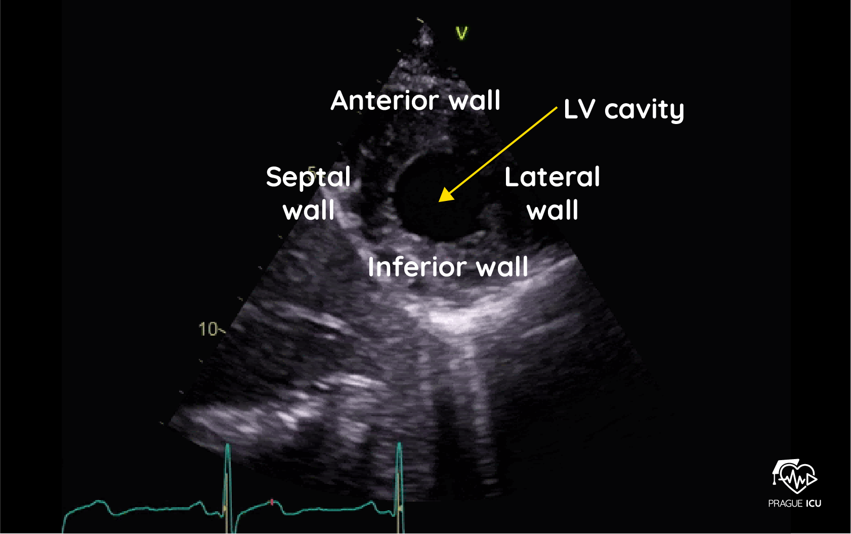 <p>For this image define the probe location, index mark orientation, and how to obtain this image.</p>