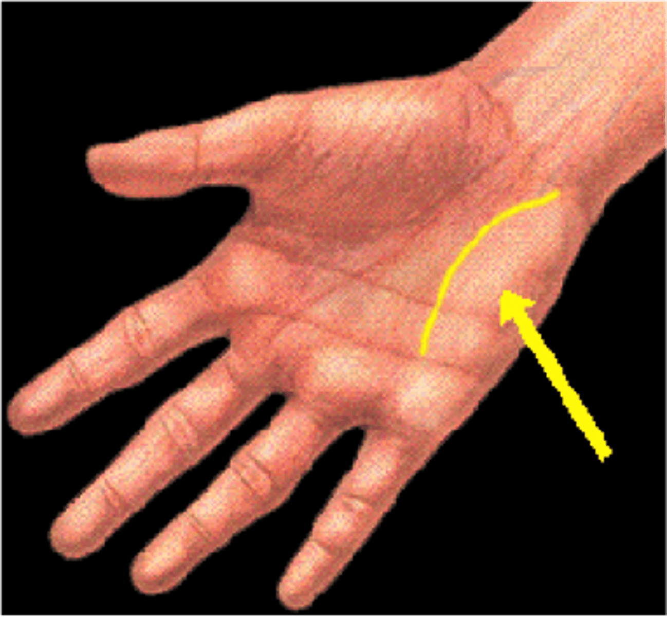 <p>little finger</p>