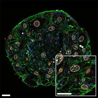 <p>describe confocal </p>