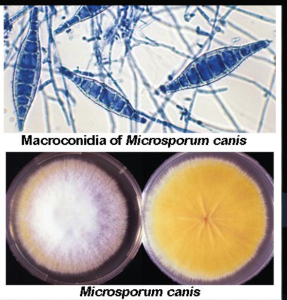 <p>Aspect Macroscopique :</p><ul><li><p>Recto = Blanc, Aspect duveteuse en forme étoile</p></li><li><p>Verso = Jaune-Orange</p></li></ul><p></p><p>Aspect microscopique:</p><ul><li><p>Macroconidies en fusiforme, paroi épaisse, <strong><em><u>présence de logette</u></em></strong></p></li><li><p>Microconidies piriforme et rare</p></li><li><p>Filaments mycéliens septés</p></li></ul><p></p>