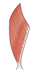 <p>What kind of muscle shape is this? Describe it.</p>