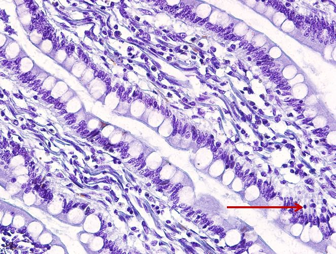 <p>Tế bào gì ?</p>