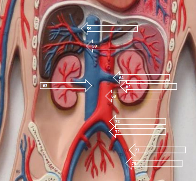 <p>Label this image.</p>