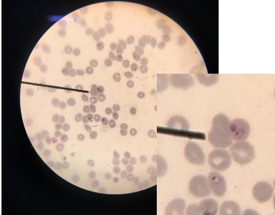 <p>Identifique a forma de vida desse parasita, onde ele pode ser encontrado e uma profilaxia pra doença</p>