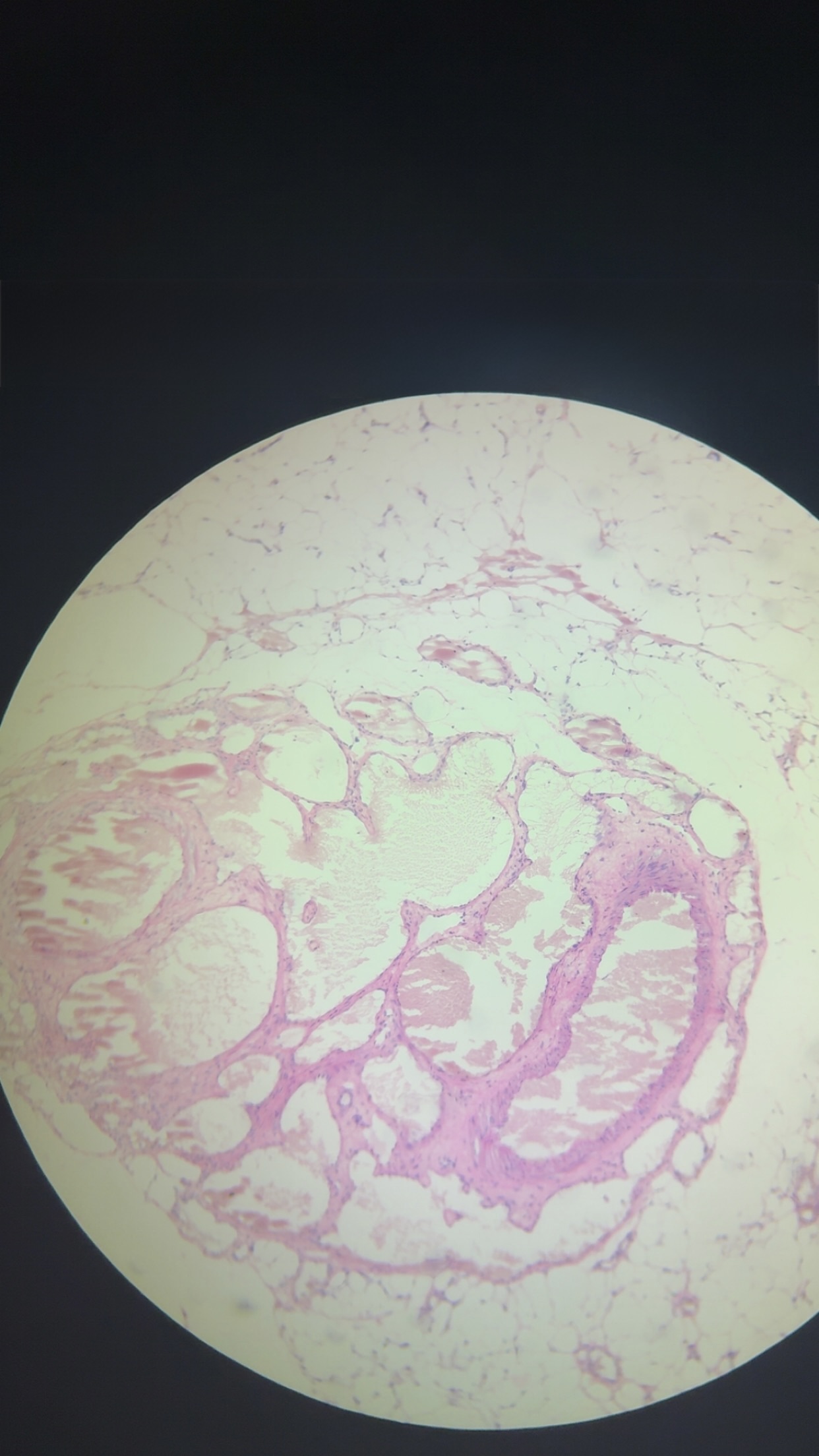 <p>what is this tissue</p>
