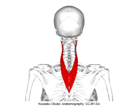 <p>What’s the name of the muscle, and its OIAN</p>