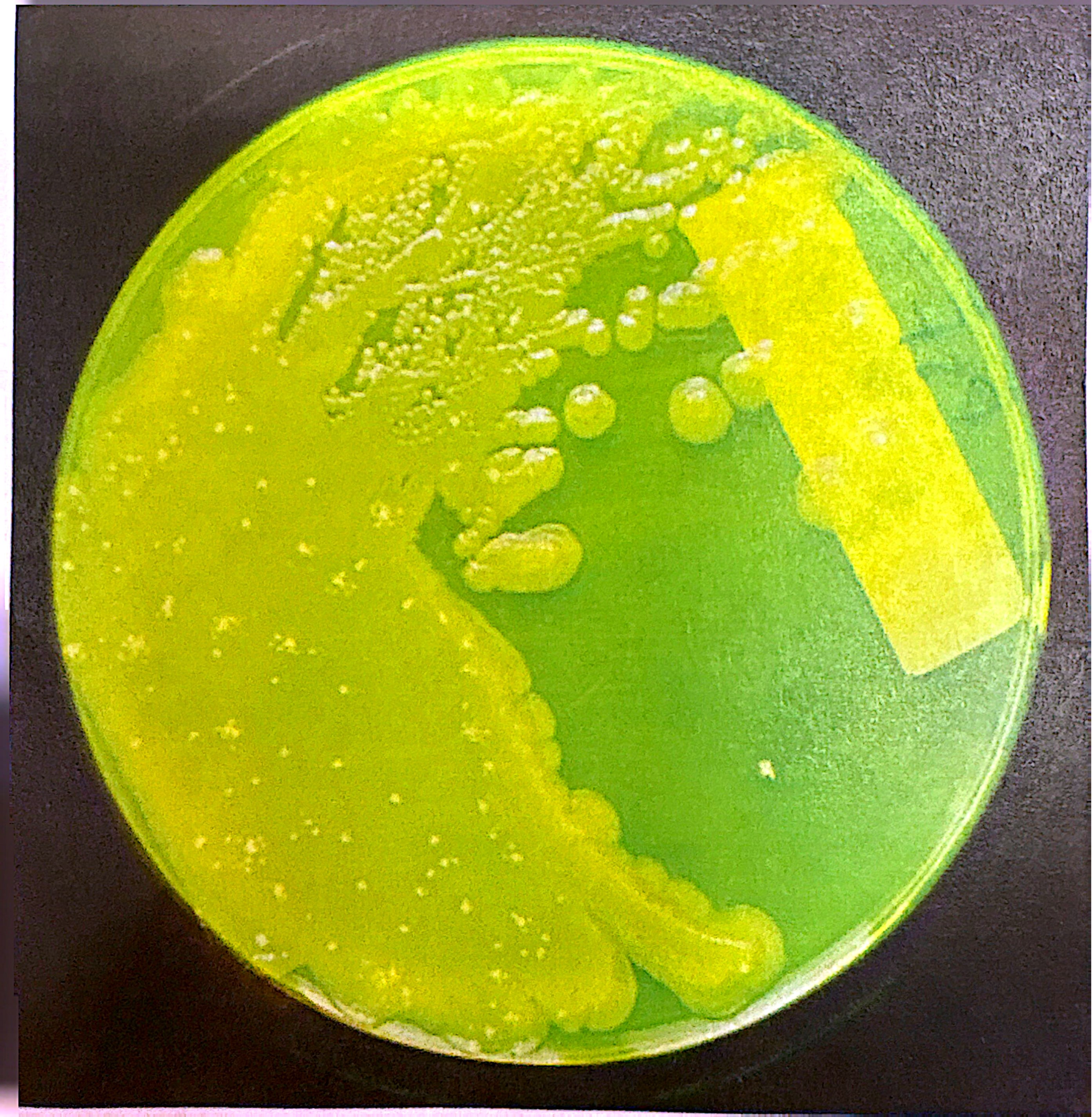 <p>Yellow-green pigment </p>