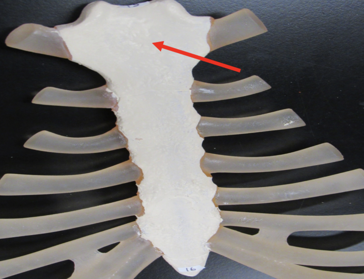 <p><span><strong>Identify the bone marking indicated by the pointer.</strong></span></p>