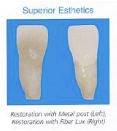 <p>translucent or opaque fiber resin materials; reflects the natural hues of the tooth and eliminates shadows though all ceramic crowns or composite restorations at the gingival/crown interface </p>