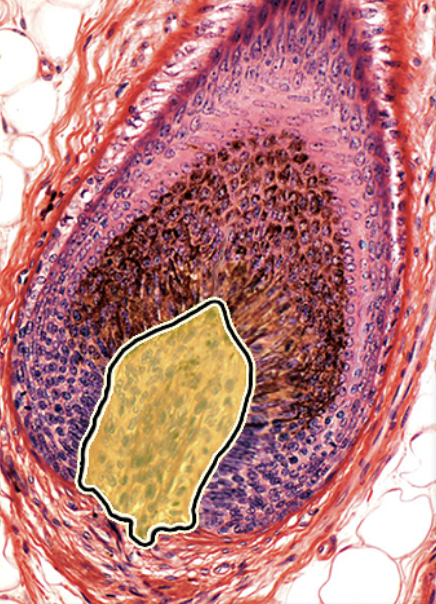 term image