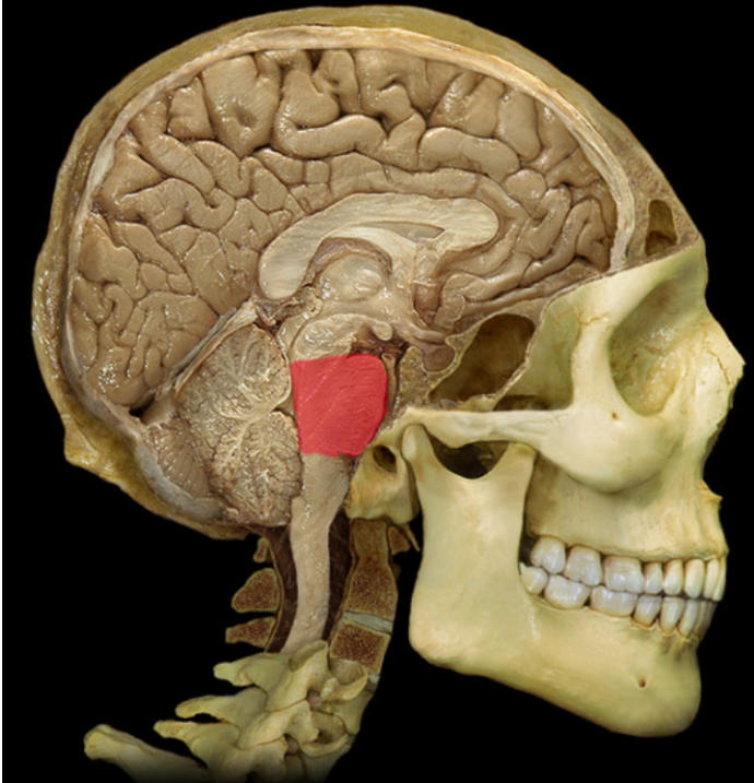 term image