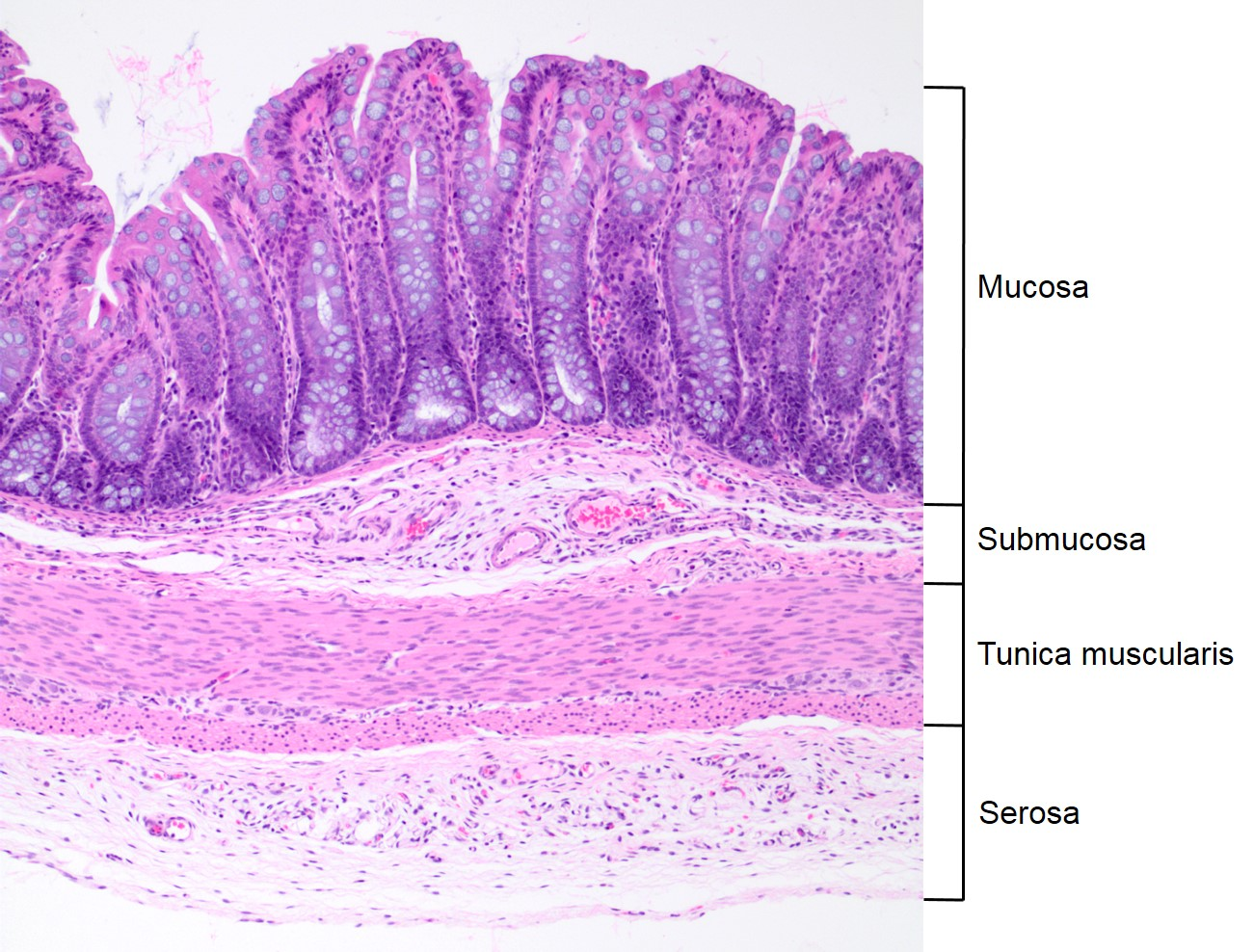 <p>additional nerve cells <strong>change chemical odors</strong> → <strong>chemical impulses</strong> &amp; <strong>send </strong>through olfactory bulb (CN I) to brain</p><ul><li><p><strong>ciliated cell</strong>: mucous transport</p></li><li><p><strong>goblet cell</strong>: mucous production</p></li><li><p><strong>connective tissue</strong></p></li></ul><p></p><p><strong>pseudostratified columnar</strong> epithelium</p>