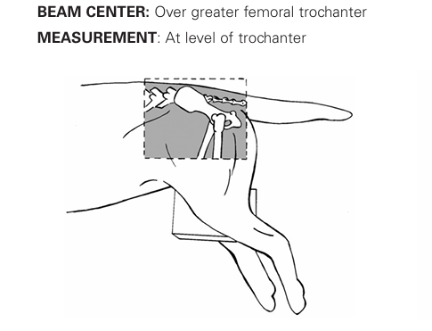 <p>lateral view pelvis</p>