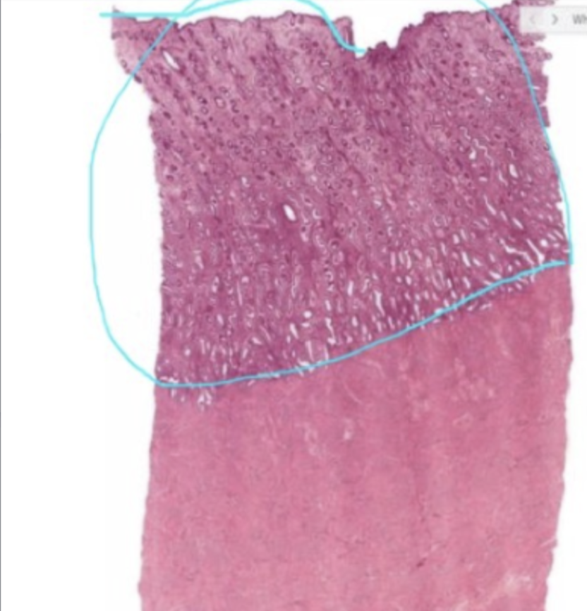 <p>identify the organ and stage</p>