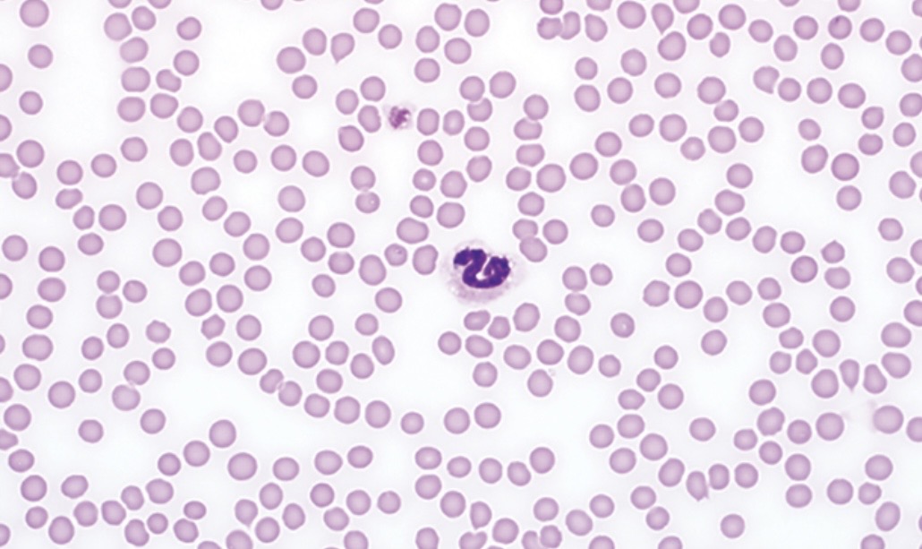 <p>Describe these platelets</p><p></p>