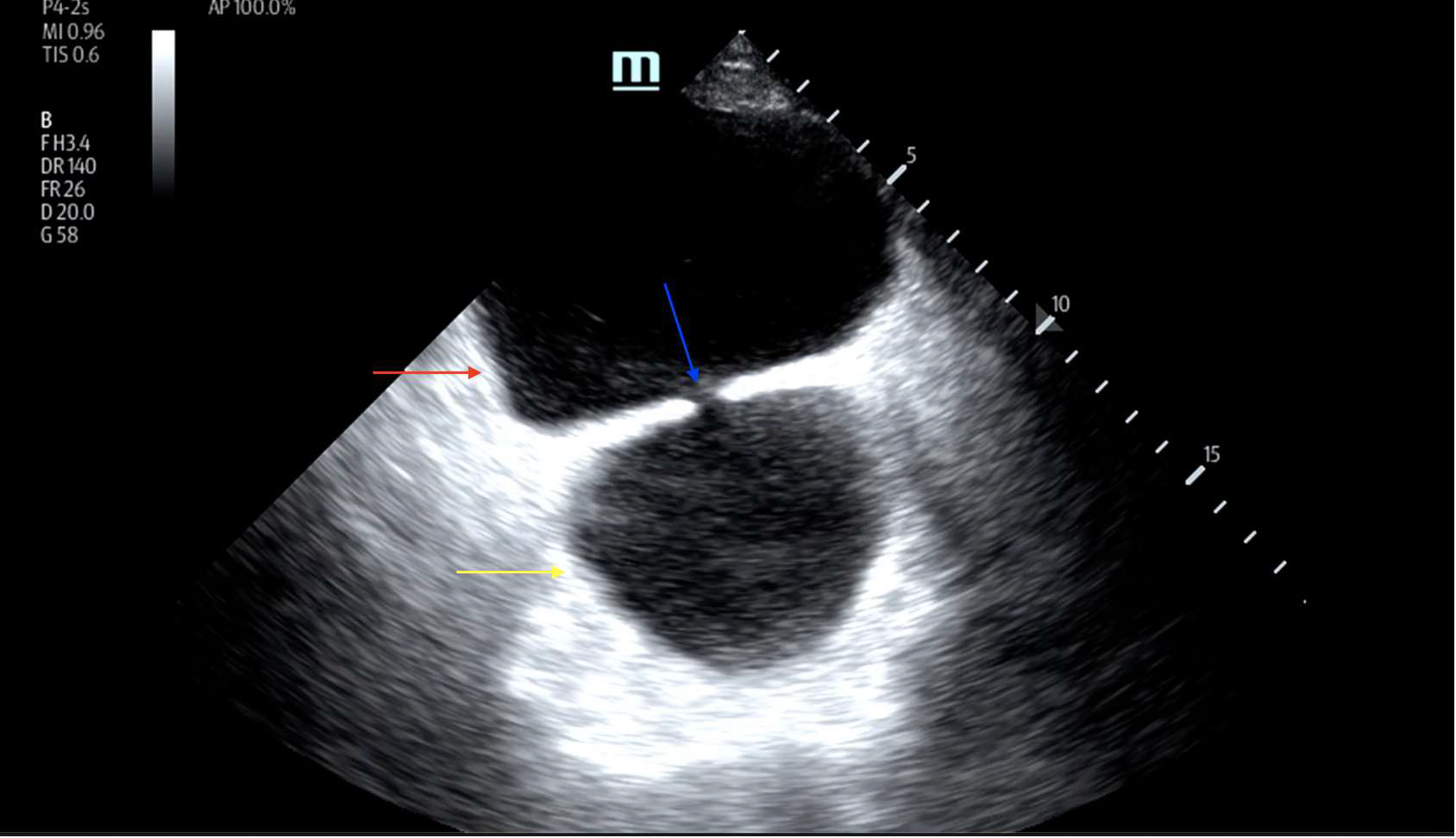 <p>What is this X-ray showing?</p>
