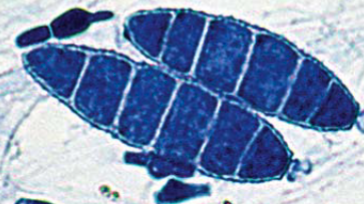 <p>“spindle-shaped” macroconidia w/ truncated ends</p>