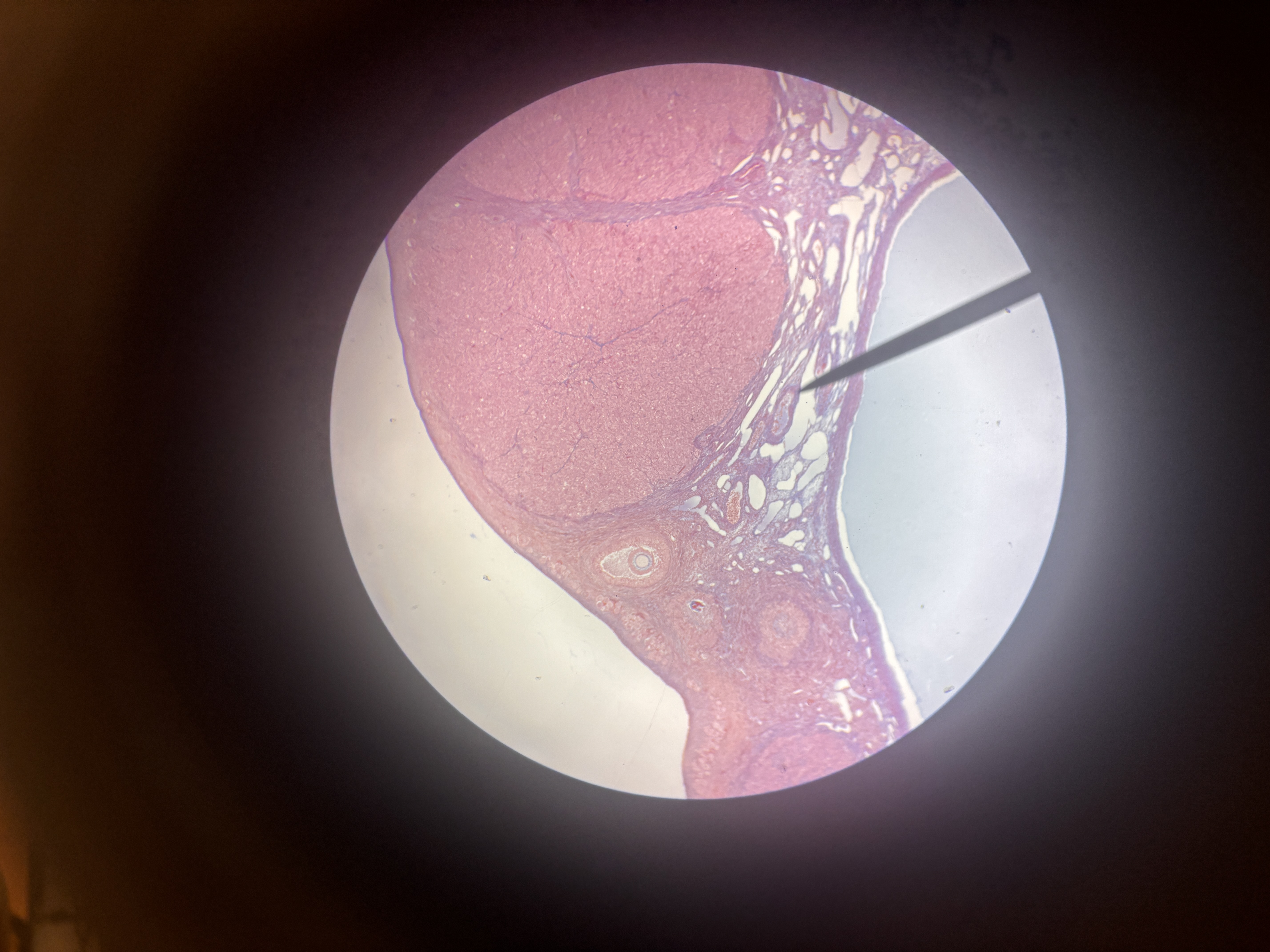 <p>What slide is this?</p>