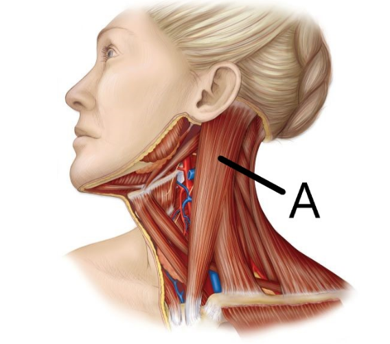 <p>what neck muscle is this</p>