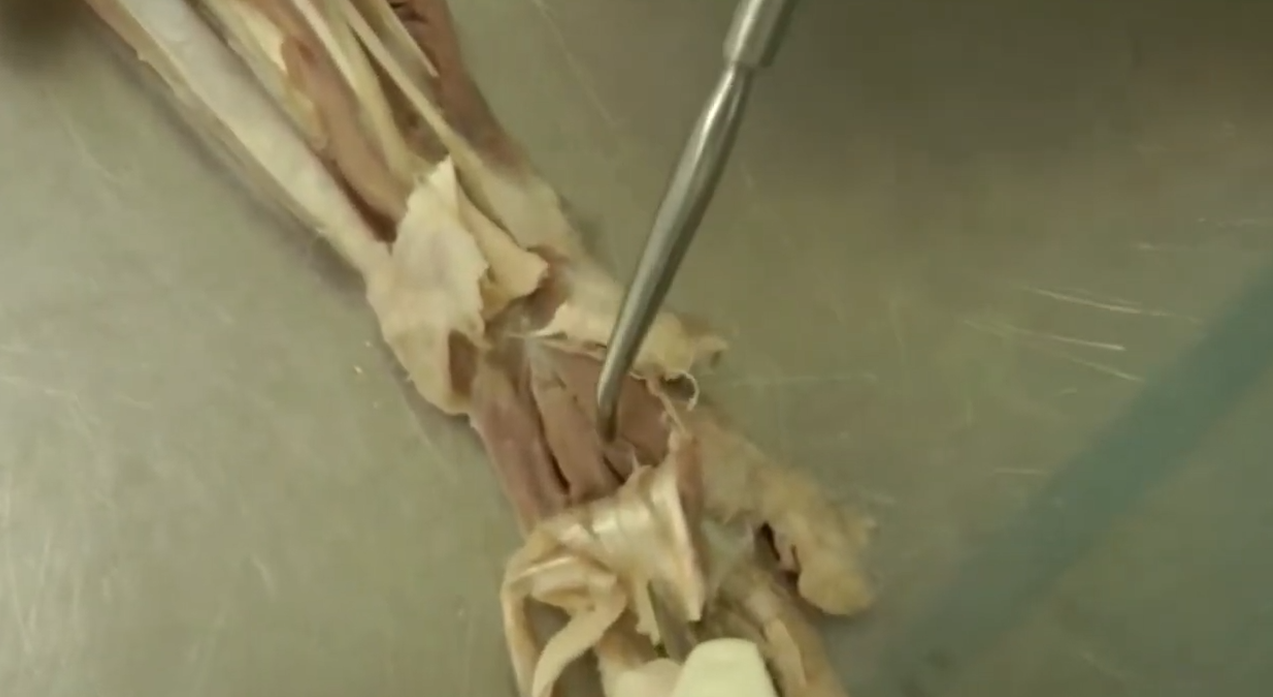 <p>muscle</p>