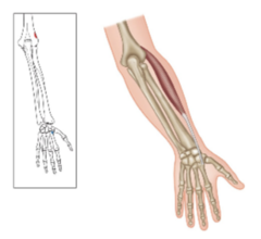 <p>What muscle is shown?</p>